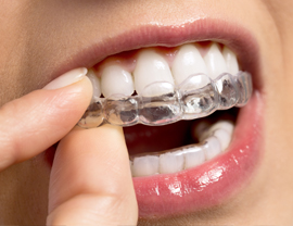 invisalign in clapham